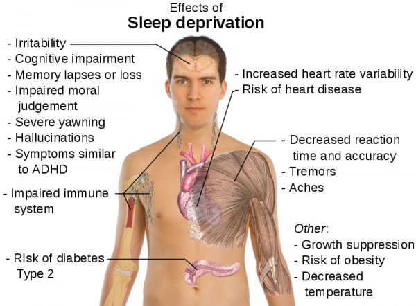 sleep-deprivation
