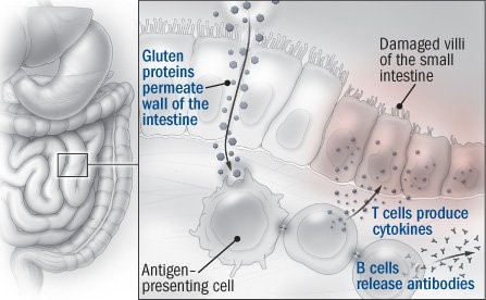 Gluten